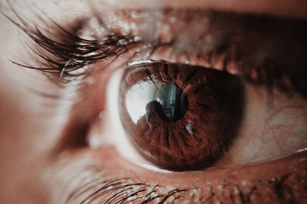 Braun classics myopia
